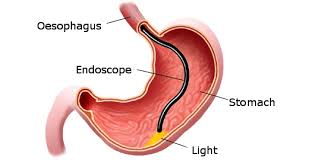 Acidity & GI tretament | Gastroenterologist In Nashik |Dr. Nitin Borse